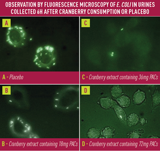 fluorescence microscopy of E. coli_cranberry